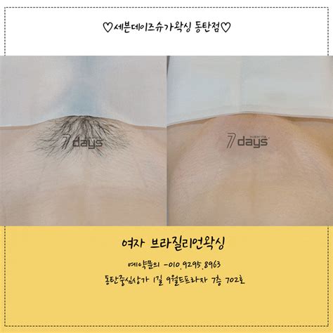 시술사진 포함) 여자 브라질리언 왁싱 종류를 알아보자! : 네이버 .